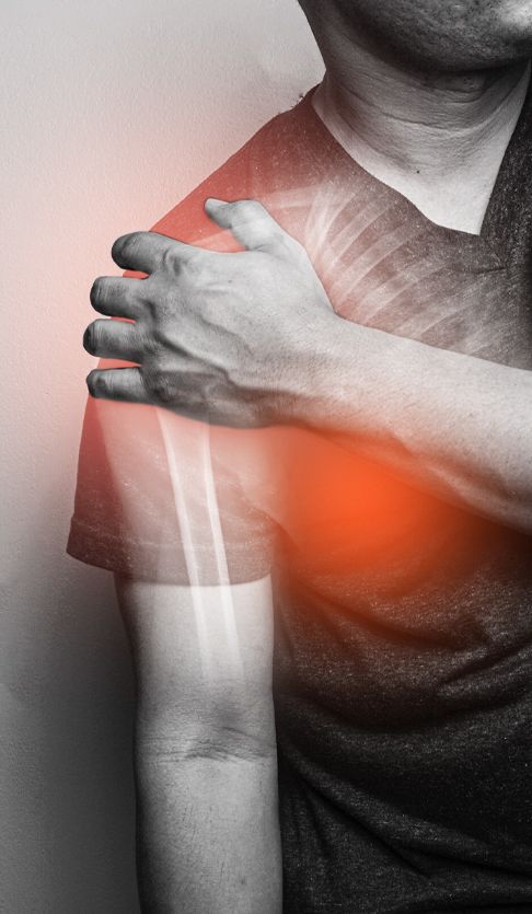 Shoulder Arthritis