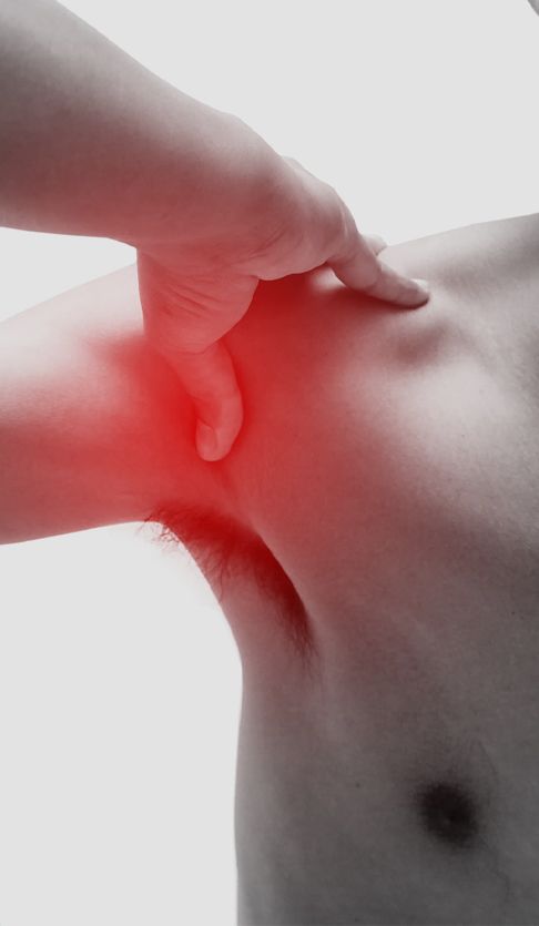 Shoulder Dislocation