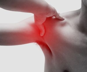 Shoulder Dislocation