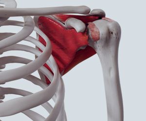 Rotator Cuff Tear